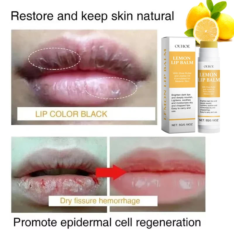 Vitamina c remover bálsamo labial escuro clarear melanina