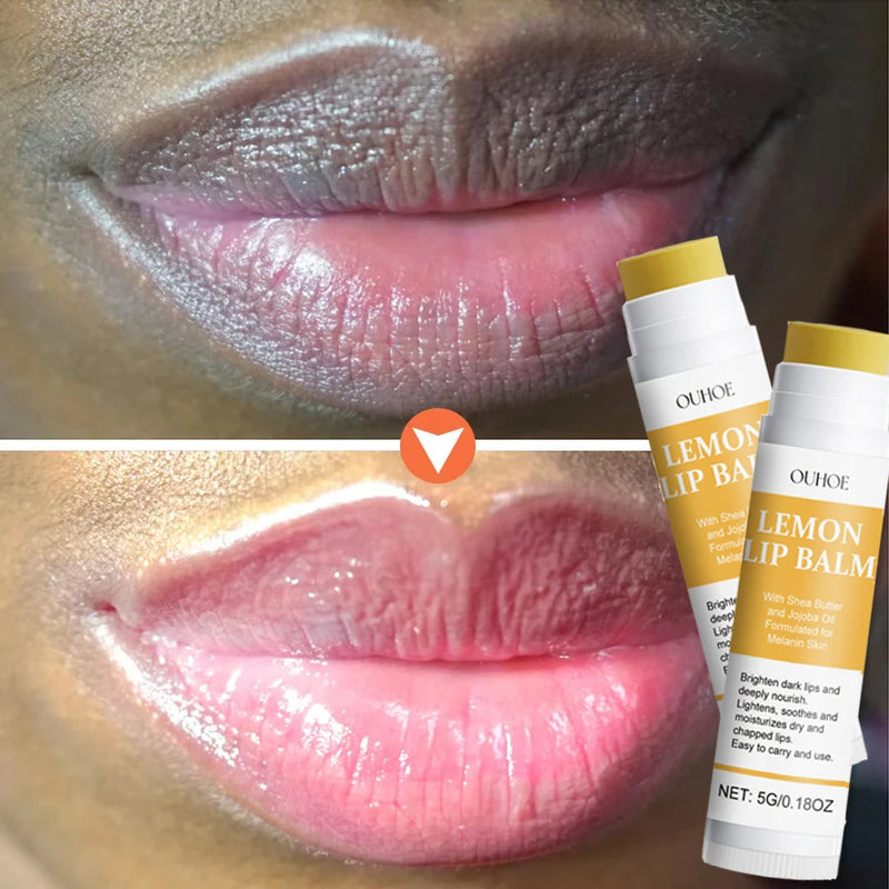 Vitamina c remover bálsamo labial escuro clarear melanina